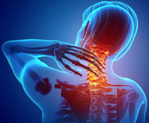 Neck Pain